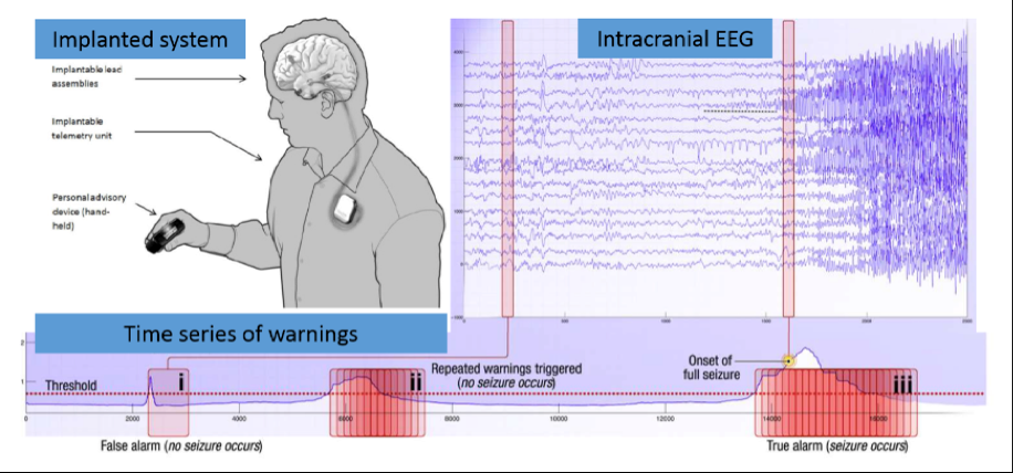 Kaggle: Melbourne University AES/MathWorks/NIH Seizure Prediction