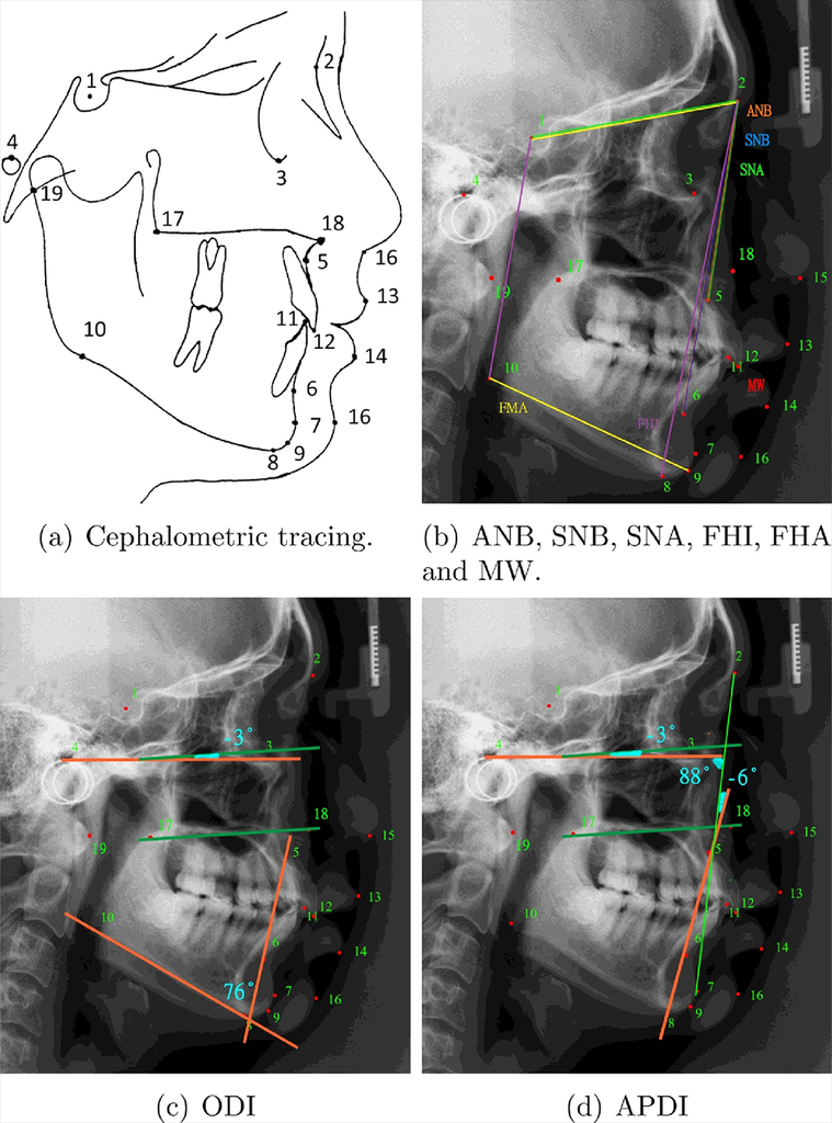 A benchmark for comparison of dental radiography analysis algorithms