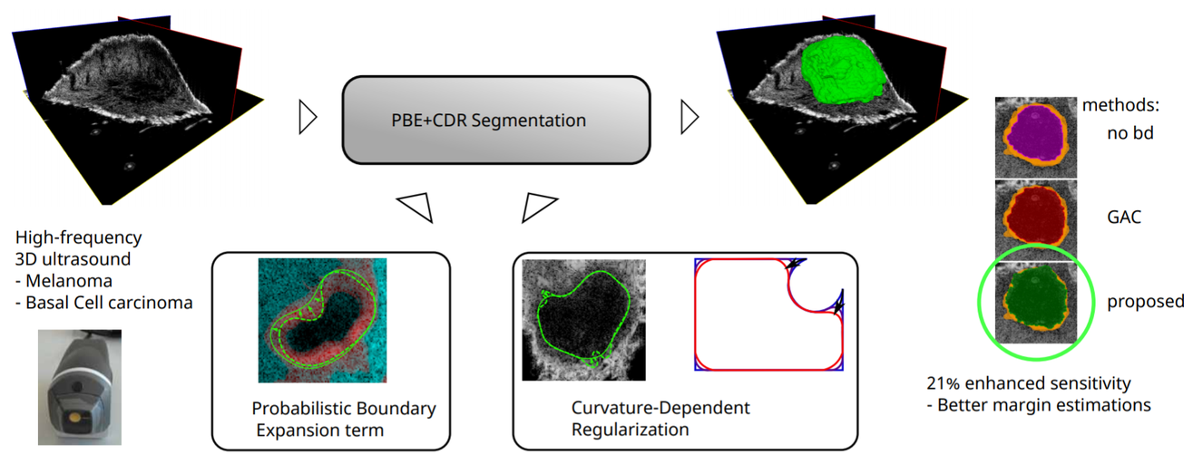 Improved boundary segmentation of skin lesions in high-frequency 3D ultrasound