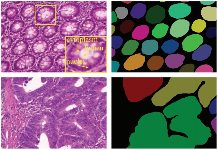 DCAN: Deep contour-aware networks for object instance segmentation from histology images