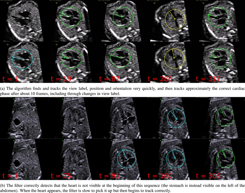 Automated annotation and quantitative description of ultrasound videos of the fetal heart